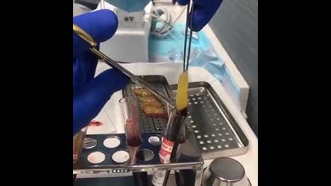 PRF box GRF Surgery instruments  prf box for rich membrin  prf process prfbox grf available