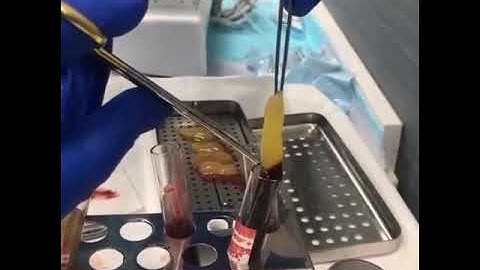 PRF box GRF Surgery instruments  prf box for rich membrin  prf process prfbox grf available