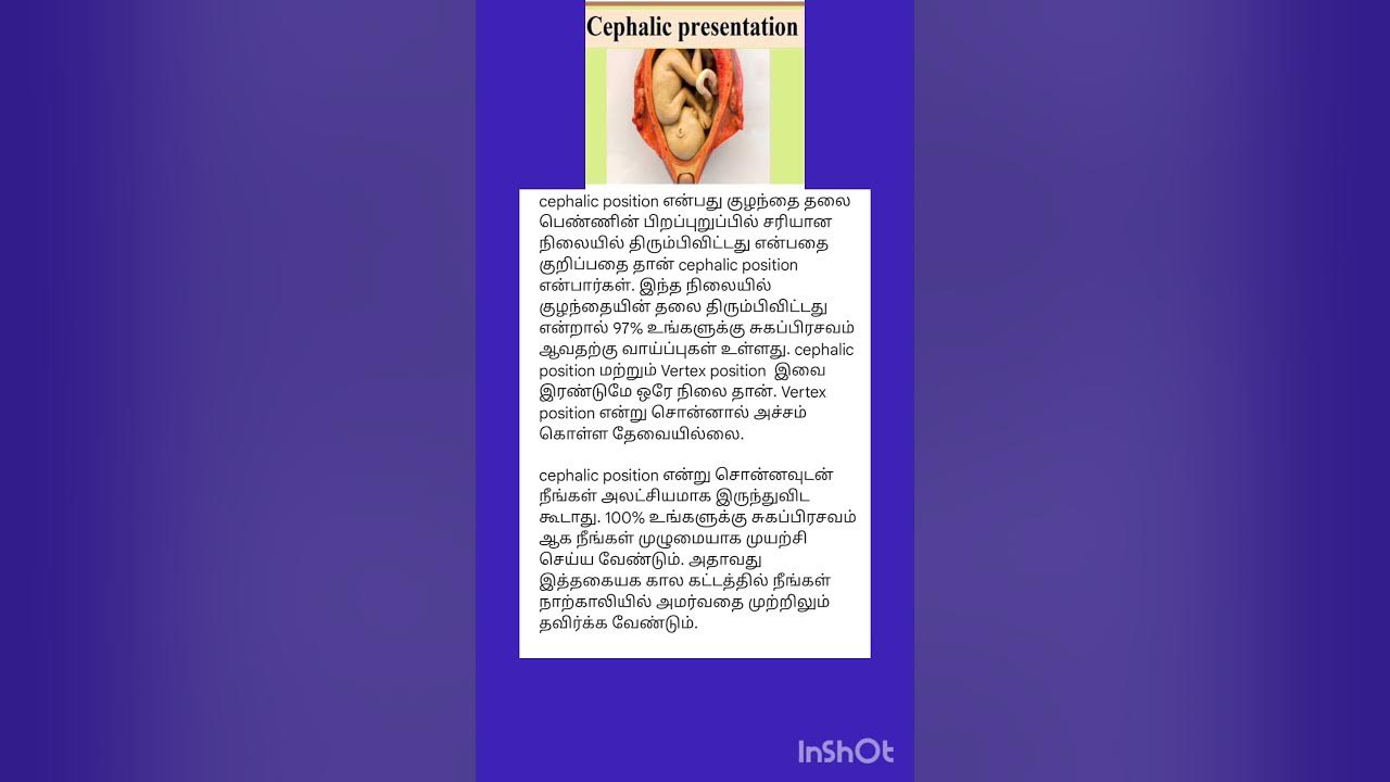 Cephalic Cephalic Meaning In Tamil cephalicposition shorts trending cephalic-cephalic-meaning-in-tamil-cephalicposition-shorts-trending