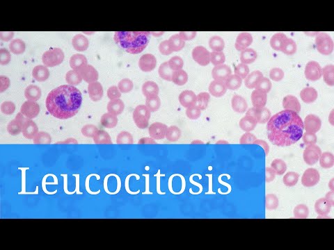 Vídeo: Leucocitosis: Causas, Clasificación, Síntomas, Tratamiento