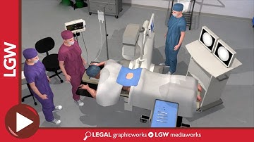 Bilateral S1Transforaminal Epidural Steroid Injection ESI 3D Animation