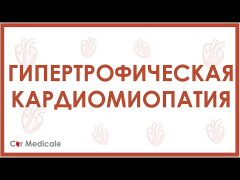 Гипертрофическая кардиомиопатия - причины, механизмы, симптомы, последствия