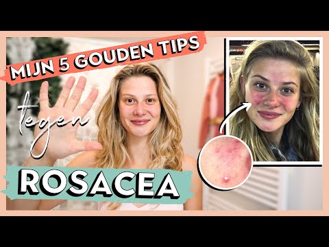 Video: Wat Is De Beste Manier Om Rosacea Te Verwijderen? Behandelingen En Meer