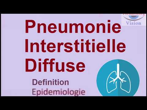 Vidéo: Évaluation De La Réunion Multidisciplinaire Sur Les Maladies Pulmonaires Interstitielles: Une Enquête Auprès Des Centres D'experts