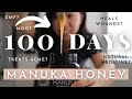 How 100 days of manuka honey changed me