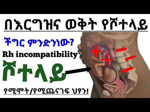 በእርግዝና ወቅት የሾተላይ ችግር ምክንያት እና መፍትሄ | Rh incompatibility During pregnancy|Health education -ስለጤናዎ ይወቁ