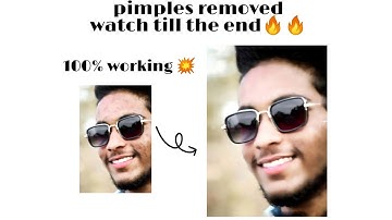 How to remove pimples and SMOOTH Skin in Snapseed tutorial 2021|| pimples cleaner‼️#facesmooth #art
