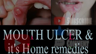 MOUTH ULCER/SORES & ITs HOME REMEDIES.?homeremedies home mouthulcer pailfulrelief