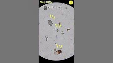 Egg Shells Contain Salmonella Bacteria ? | TULO - Microscope #shorts #microscope #egg