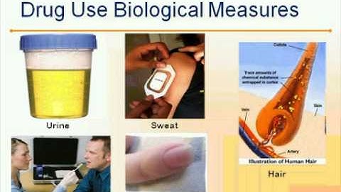 CTN Webinar: The Value of Common Data Elements.