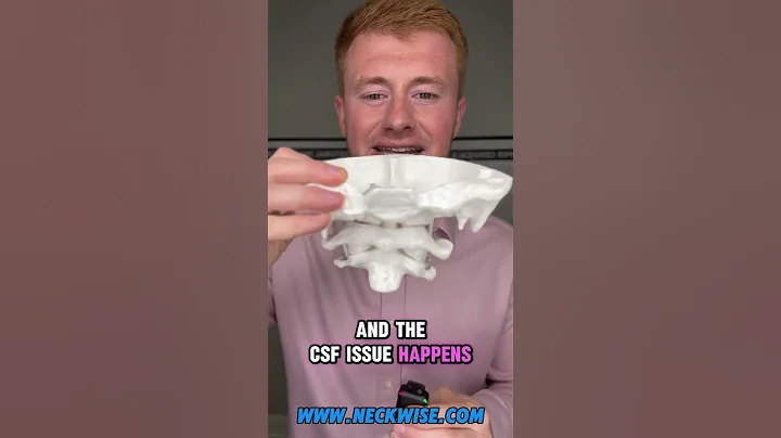 migraines, headaches, idiopathic, intracranial  hypertension l upper cervical care at Neckwise