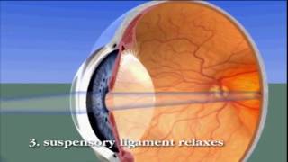 You can see clearly without glasses(Beware science Ahead)//.Hindi(हिंदी) screenshot 4