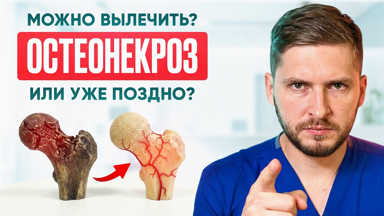 Остеонекроз — не приговор: когда кость можно спасти и как действовать?