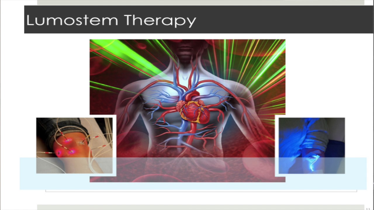 MarrApose Stem Cell Therapy Using LumeStem Activation in Sarasota