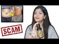 Belly Drainage Ginger oil for weight loss|meesho ginger oil for weight loss|meesho slimming oil|2023