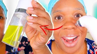 Does The Water Blackhead Remover Really Work?