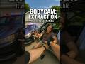 BODYCAM  Painful Extraction