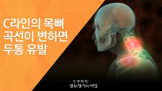 C라인의 목뼈 곡선이 변하면 두통 유발 - (20120526_414회 방송)_인체의 사이렌, 통증 2편 - 두통