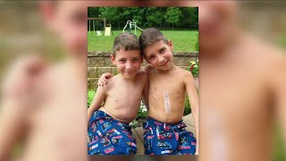 Twins with rare condition undergo groundbreaking surgery to replace pacemakers