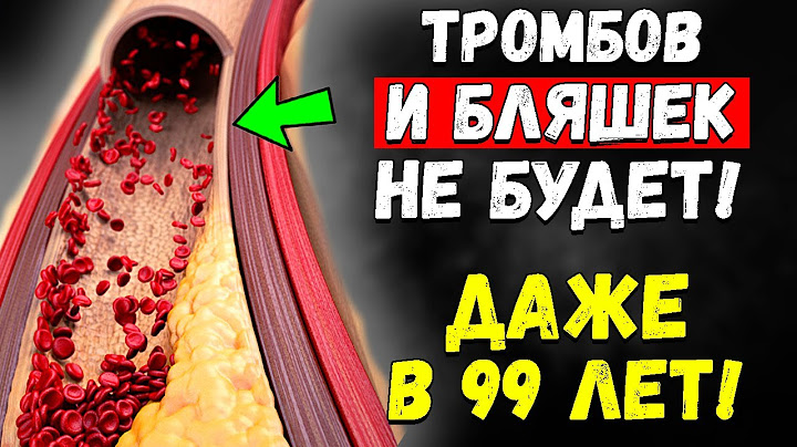 ЭТО СПАСЕТ от образования кальциевых БЛЯШЕК в артериях и сердце, НУЖНО ТОЛЬКО...