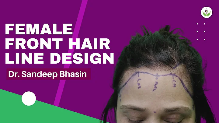 Incredible Transformation - Watch a Female Hairlin...