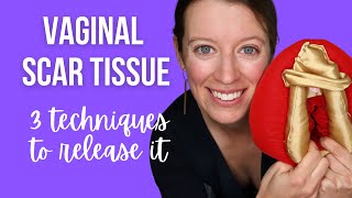 Vaginal scar tissue: 3 techniques to self-release it