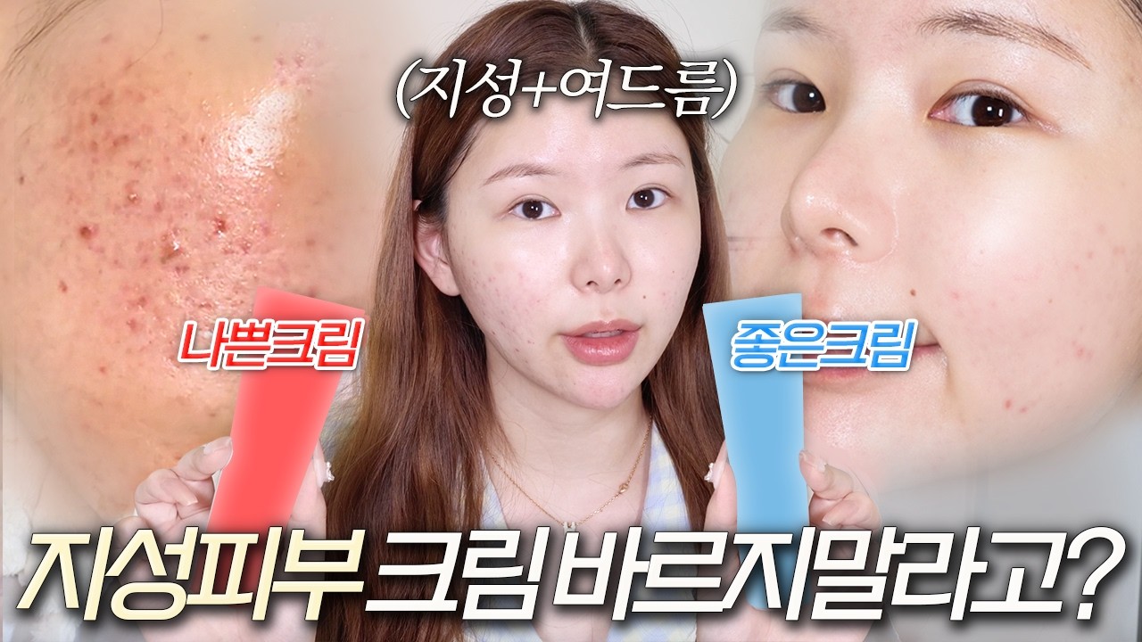 극지성+여드름 10년차🔥 지성이라고 크림 안 바르면 큰일나요...🚨