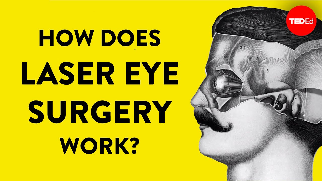 How Does Laser Eye Surgery Work? - Dan Reinstein