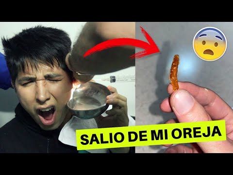 Mi primera LIMPIEZA DE OIDO (Lo grabe todo) 😱 - TODOS DEBERÍAN VER ESTO!