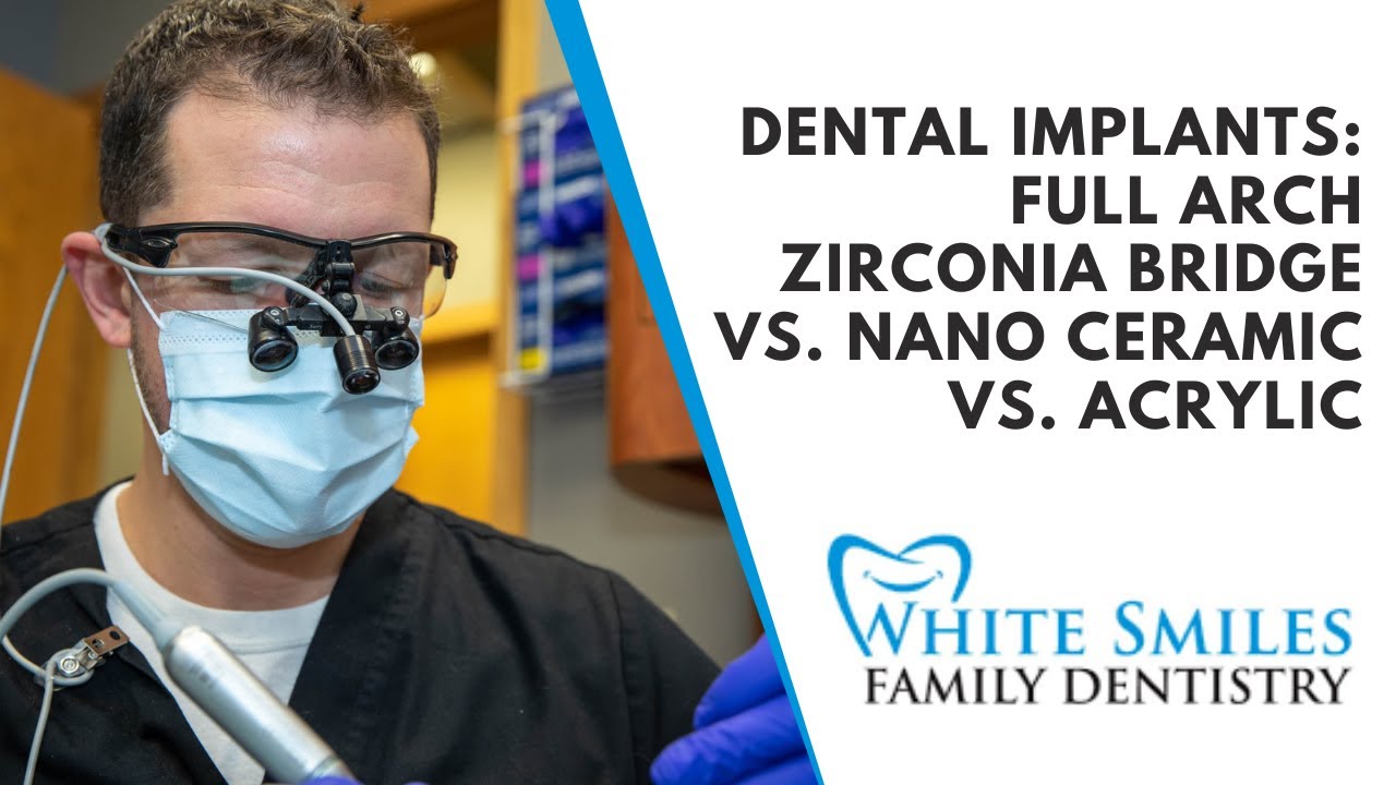 Dental Implants Full Arch Zirconia Bridge vs Nano Ceramic vs Acrylic