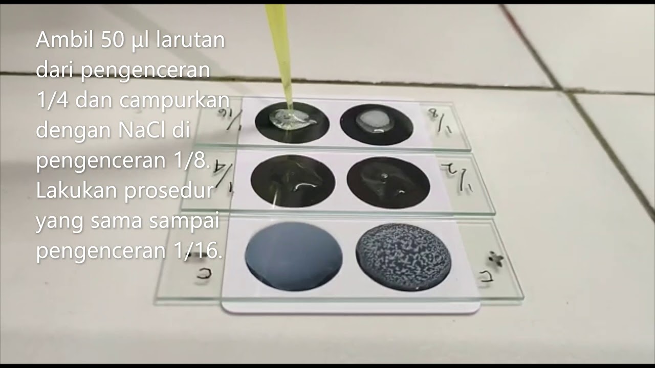 Pemeriksaan CRP Semi-kuantitatif