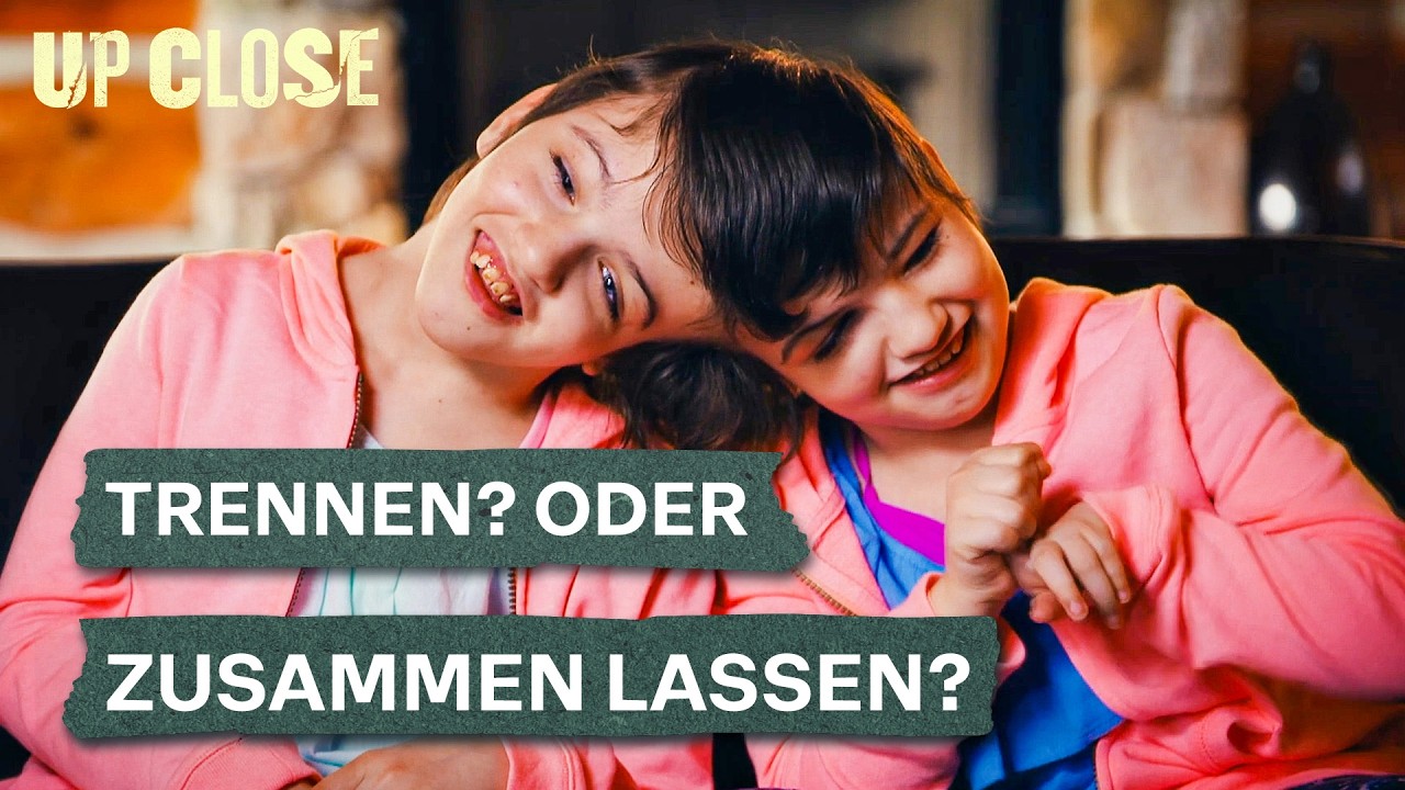 Diese siamesischen Zwillinge stellen ihre Eltern vor eine unmögliche Wahl | Teil 1