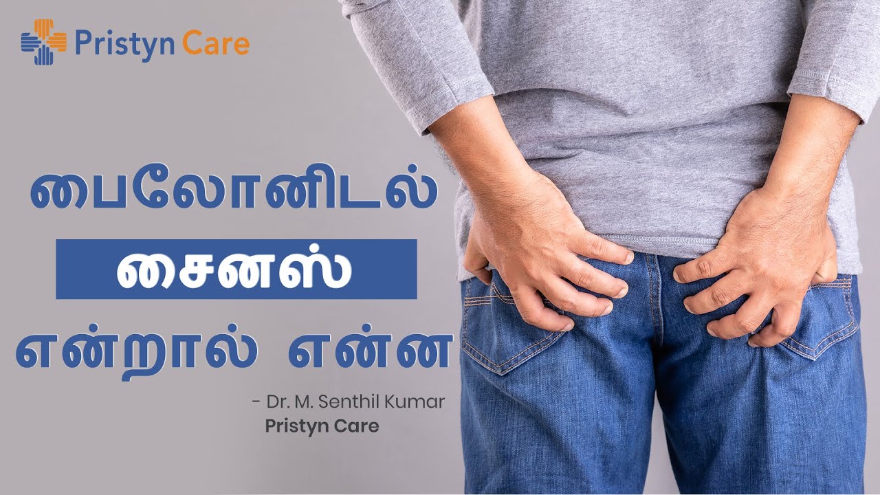 What is Pilonidal Sinus | பைலோனிடல் சைனஸ் என்றால் என்ன | FREE Appointment 📞9220708788
