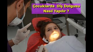 Çocuklarda Diş Dolgusu Nasıl Yapılır ? How Is Tooth Filling Done In Children?