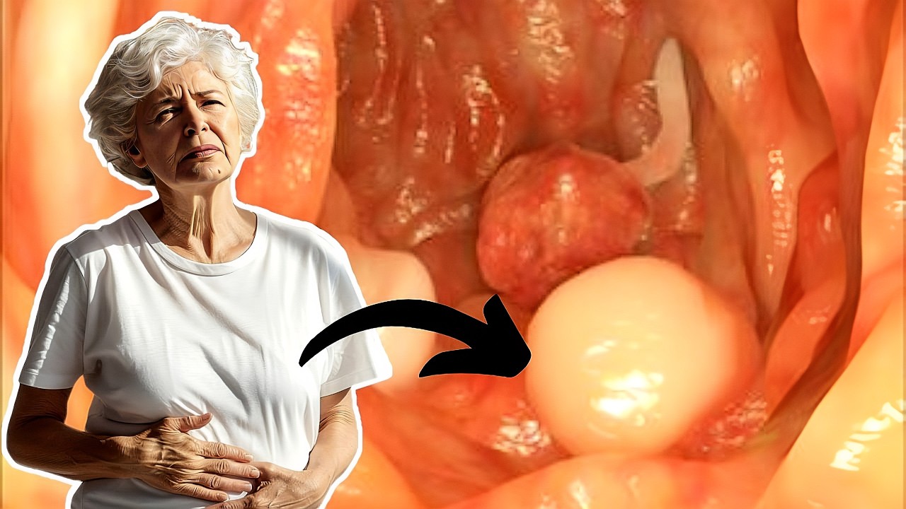 Šokantno otkriće: VITAMIN koji sprečava rak debelog crijeva!