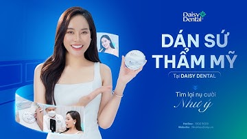 💕 Dán Răng Sứ Thẩm Mỹ - Sở Hữu Nụ Cười Như Ý Chỉ Sau 2 Lần Hẹn
