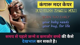 समय से पहले जन्मे व कमजोर शिशु की कैसे करे देखभाल || kangaroo mother care