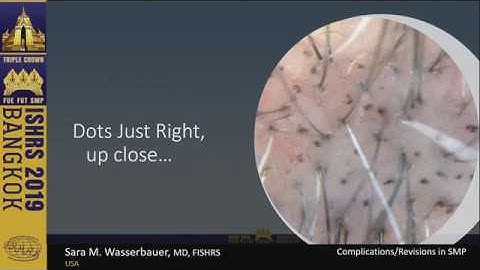 SMP Complications and Revisions - Dr. Sara Wasserbauer - ISHRS - Bangkok, Thailand