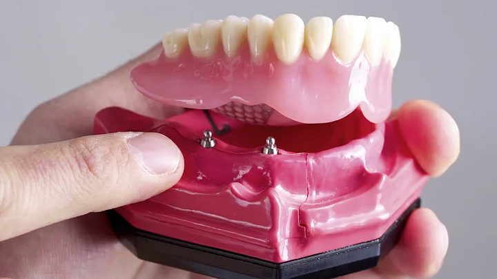 FAQ - How can I make my dentures fit better? | Dr. Darren Koch | Cary Dentist