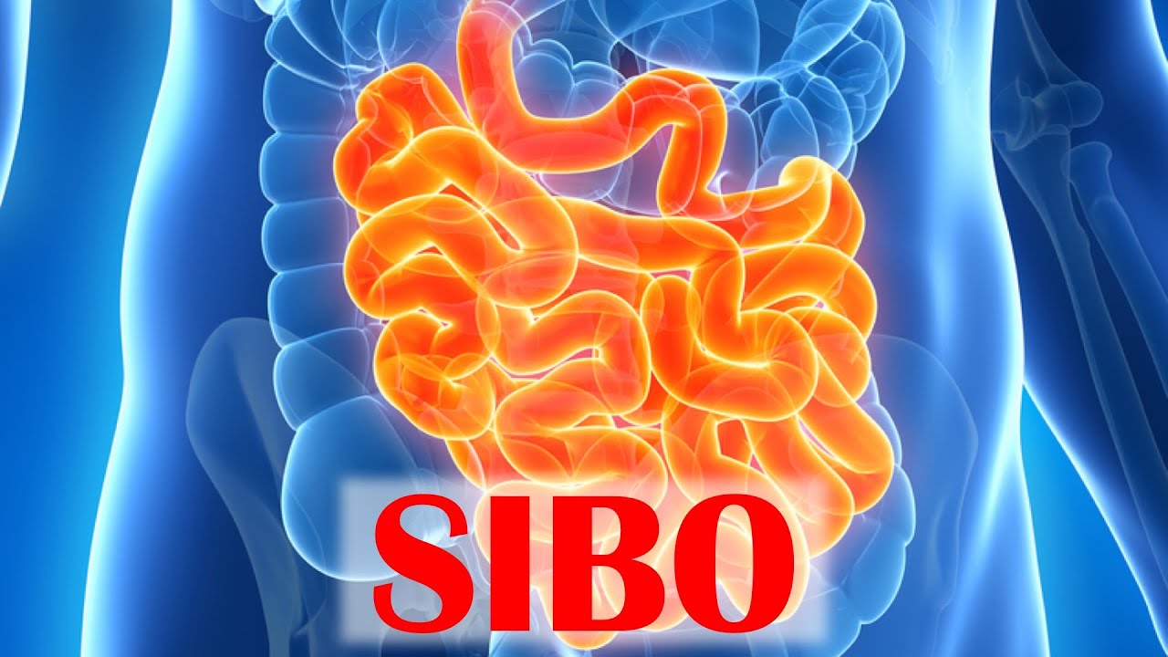 small bowel bacterial overgrowth treatment