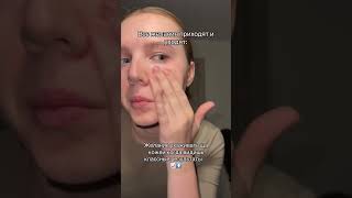 Дермаручка Wb apt: WW174214 Копируй артикул и вставляй в строку поиска на Wildberries именно с «WW»
