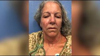 Hundreds of killer bees swarm Texas woman as she desperately tries to escape