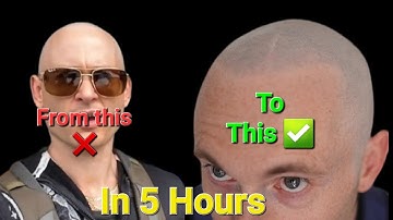 SMP Results | 1 week & 1 session later