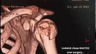 Download Lagu Todd Lodwick, Olympic Silver Medalist and USA Flag Bearer, on KAATSU the Original BFR MP3