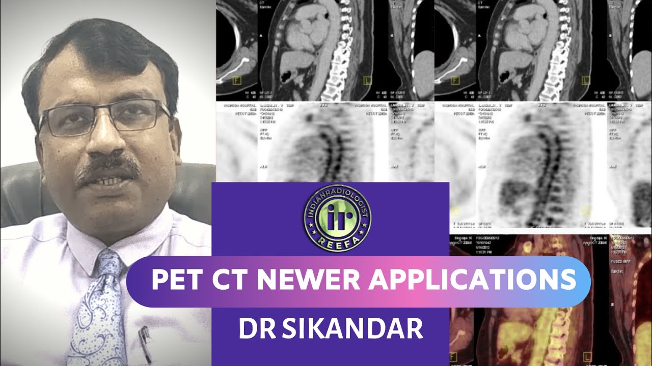 TMT: PET CT: Newer Applications by Dr Sikandar - YouTube