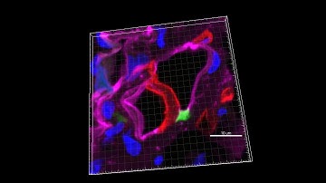 Integration of human CD31+ vessels in the mouse heart