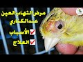 الكناري مرض التهاب العين الكناري مرض التهاب العين