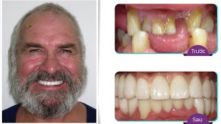 Peter Sim Cock - Tìm Lại Niềm Đam Mê Ca Hát