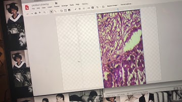 Video Lab Exercise - Endocrine System