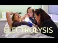 Is Electrolysis the Best Hair Removal Method? | The SASS with Susan and Sharzad